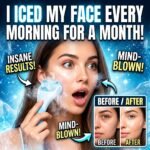 ice roller for face benefits