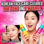korean face care for acne