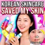korean skincare for acne