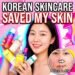 korean skincare for acne
